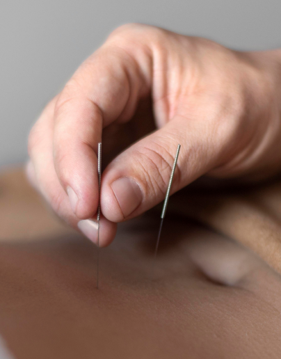 OSullivanTreatmentsAcutePain